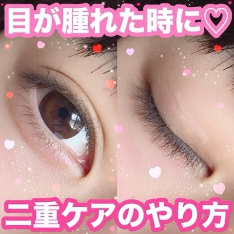 Natsumiさんのミクチャ動画 目が腫れた時にする二重ケア 元に戻るまで毎日やり続けるよ これで二重幅も広がるし最強アイテム