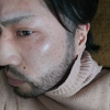 パズー