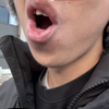 ワキガ監督